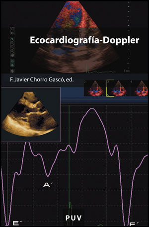 Ecocardiografía-Doppler