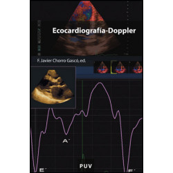 Ecocardiografía-Doppler